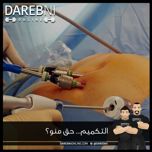 التكميم... حق منو؟