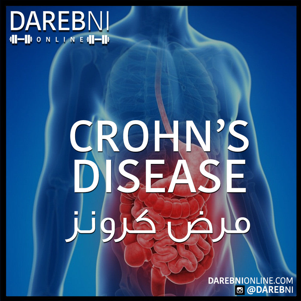 Crohn's Disease مرض كرونز